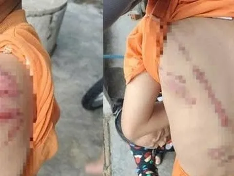 Dùng roi mây đánh con trai bầm tím cơ thể, người cha bị phạt 7,5 triệu đồng